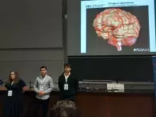 prezentacja o tętniakach mózgu